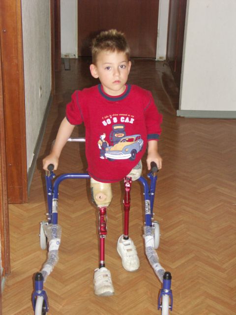 Manuel wurde ohne Beine geboren